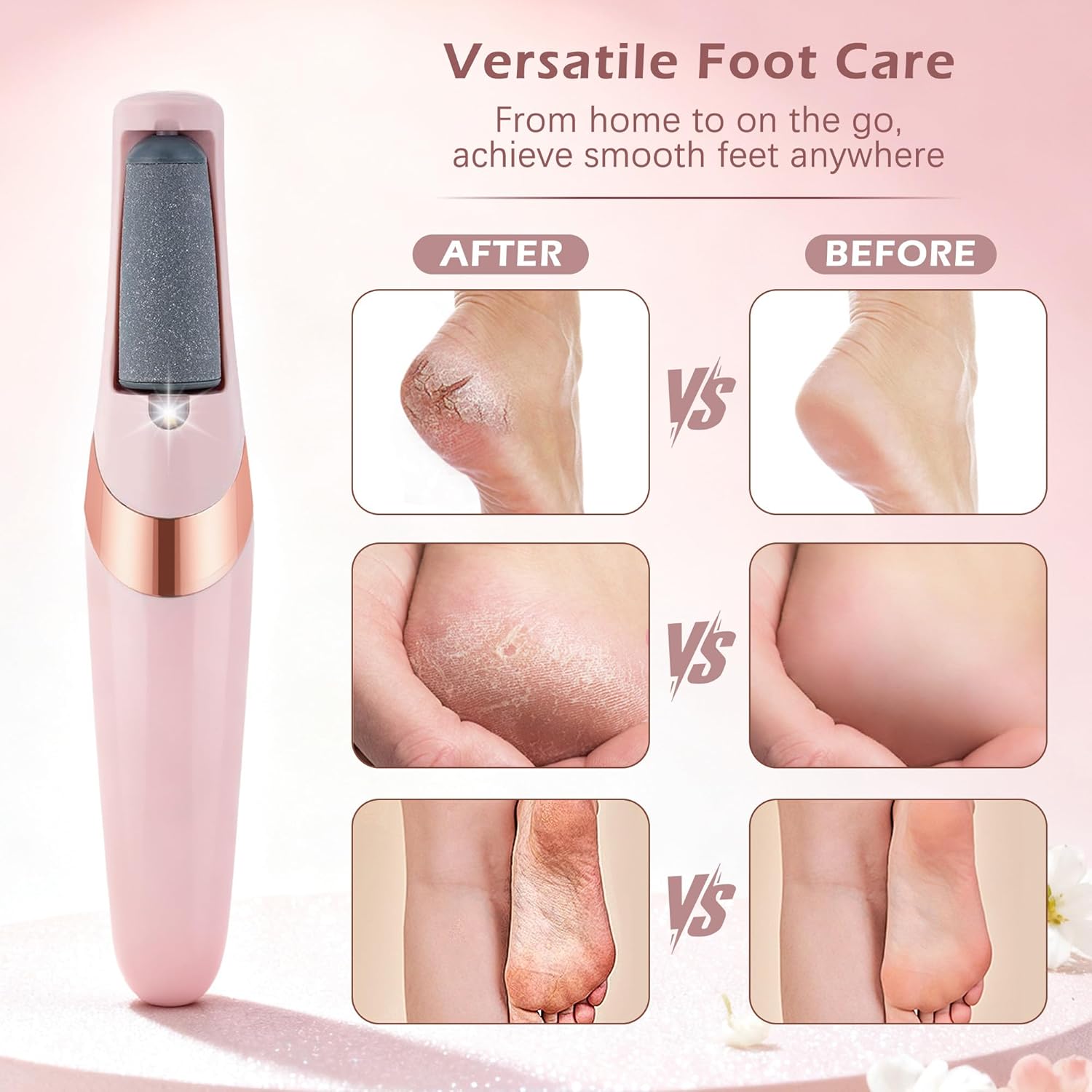 Rechargeable Electric Foot Grinder Hard Skin Remover, 2 Speeds, Coarse and Fine Heads, LED Light